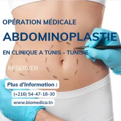 Abdominoplastie - 4