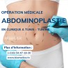 Abdominoplasty - Medical operations - 4