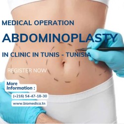 Abdominoplastie - 6