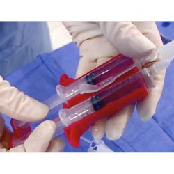 TISSEEL Baxter biological glue - Cardiac surgery -