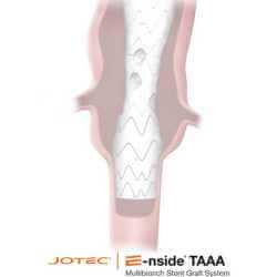 Endoprothèse thoracoabdominale E-nside TAAA - 1