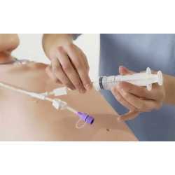 nasogastric tube Silicone - Gastroenterology - 1