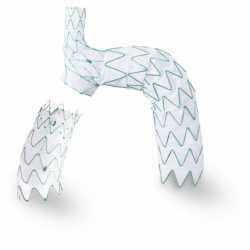 Stent d'arc aortique - 5