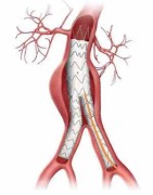 Chirurgie cardiaque | Biomedica Tunisie