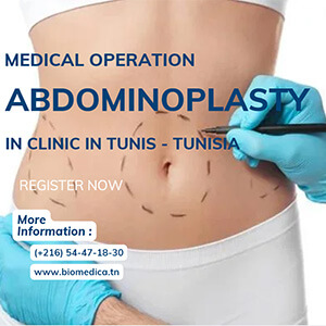 Abdominoplastie en Tunisie