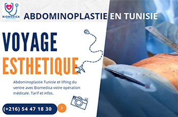 Opération médicale Abdominoplastie Tunisie