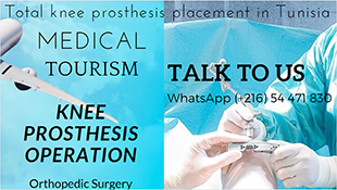 Knee prosthesis operation in Tunisia