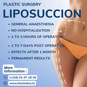 Stomach liposuction - thigh liposuction tunisia