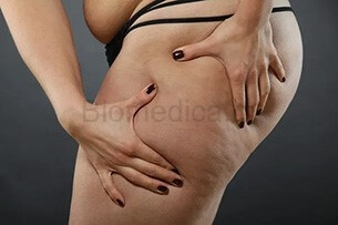 performing thigh liposuction